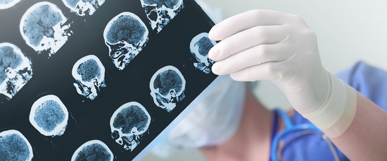 Radiology Malpractice